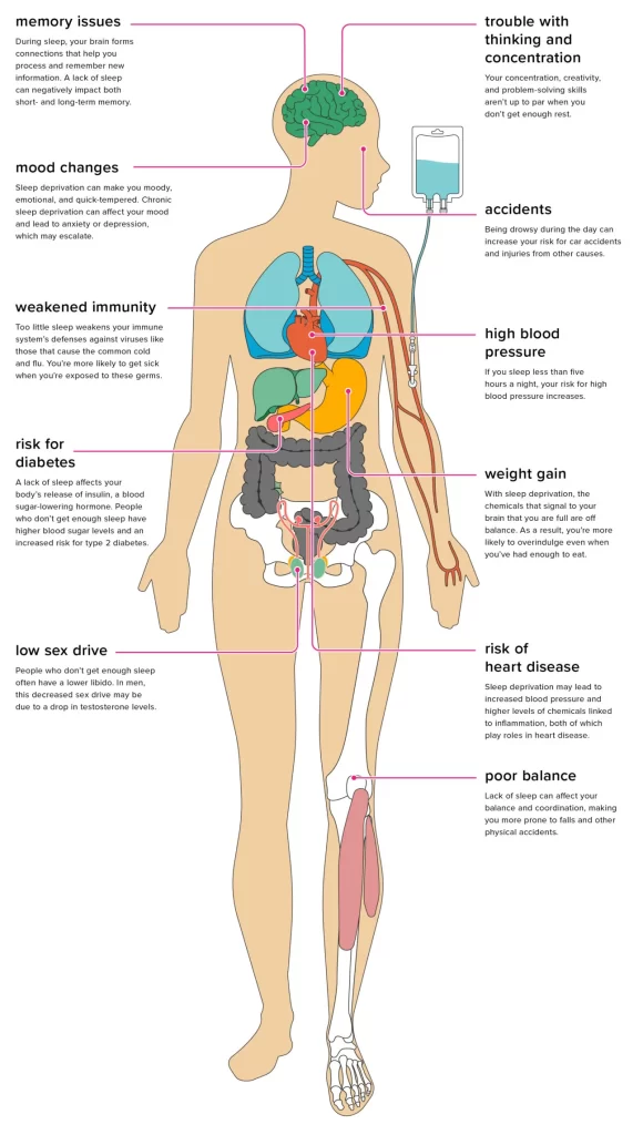 Diagram of the effects of sleep deprivation